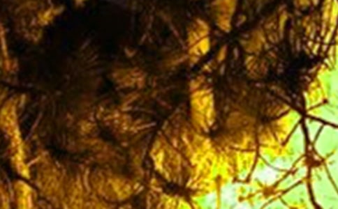 �����¹�ͻ���¼�Ӧ��Ԥ��