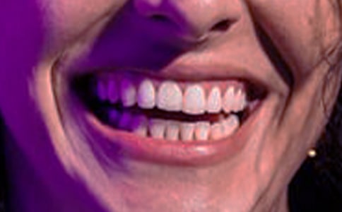 缓解牙龈肿痛的方法