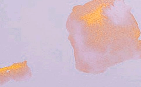 ������ƿ��챨��